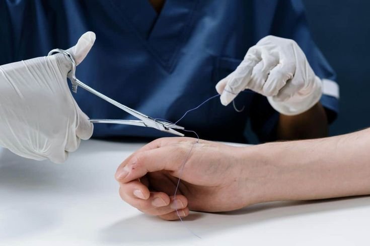 Benefits of Choosing a GP for Minor Surgical Procedures
