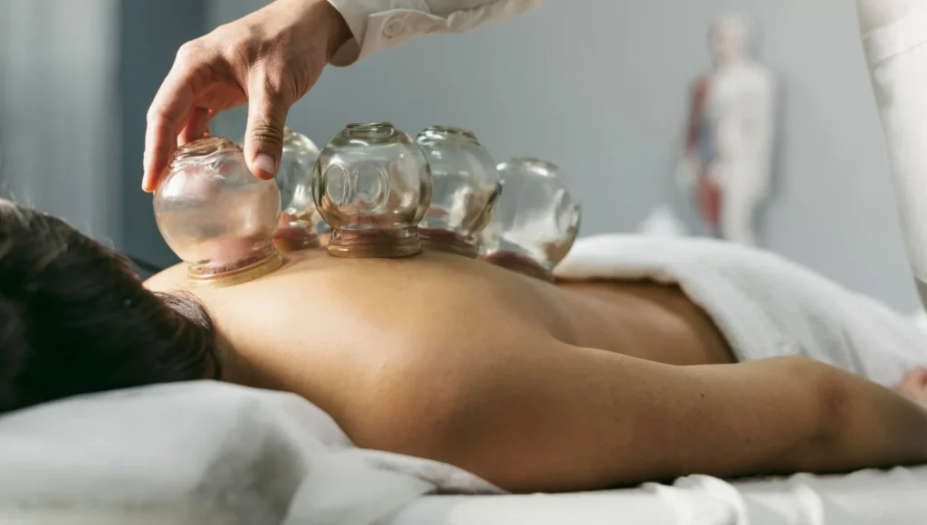 Why Cupping Therapy Is One of the Best Natural Healing Treatments