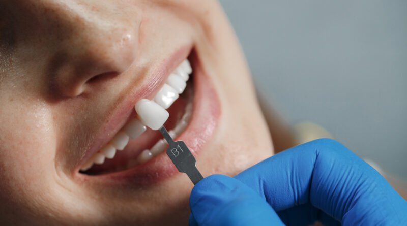 Best Ways to Replace Missing Teeth in Nashik: Dental Implants and Dentures