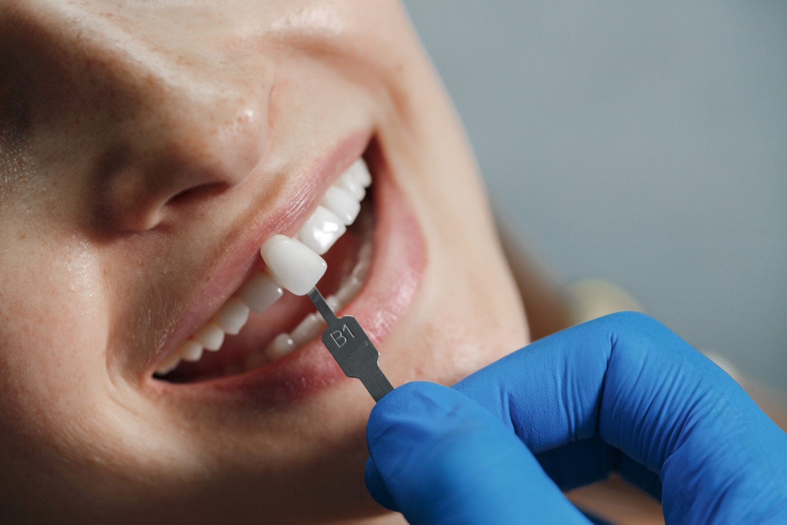 Best Ways to Replace Missing Teeth in Nashik: Dental Implants and Dentures