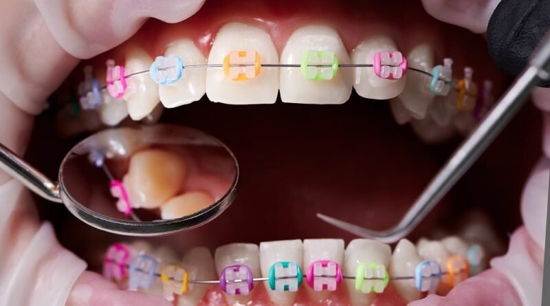 Orthodontic Treatment and Braces Near Jehan Circle, Gangapur Road, Nashik
